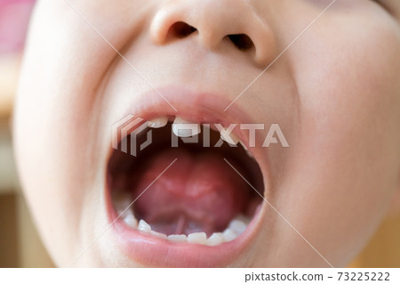 乳齒再生 73225222