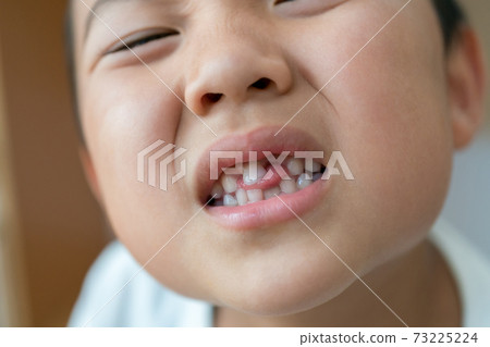 乳齒再生 73225224