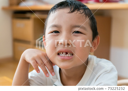 Regeneration of milk teeth Regeneration of milk teeth 73225232