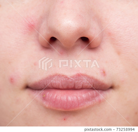 Problematic woman skin 73258994