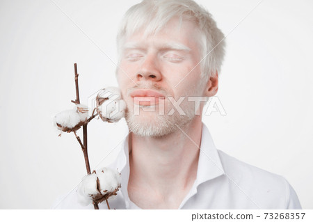 albinism albino man in studio dressed t-shirt isolated on a white background. abnormal deviations. unusual appearance albinism albino man in studio dressed t-shirt isolated on a white background. abnormal deviations. unusual appearance 73268357