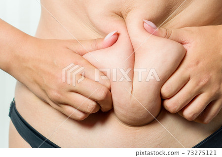 A woman holds a fold of fat at her waist. Conceptual image of obesity. Close-up, isolated on a white background. A woman holds a fold of fat at her waist. Conceptual image of obesity. Close-up, isolated on a white background. 73275121