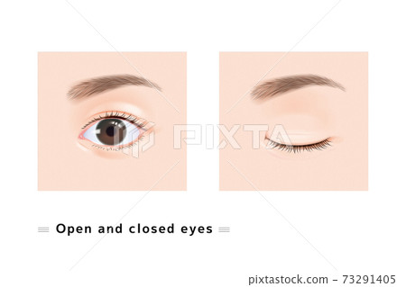 兩隻眼睛的眉毛女性臉眼睛閉眼皮眼科案例真實插圖 兩隻眼睛的眉毛女性臉眼睛閉眼皮眼科案例真實插圖 73291405