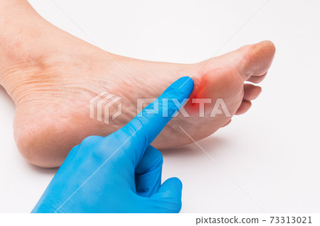 A doctor's hand in a protective medical glove touches his hand with a finger and examines the wound on the foot of an elderly woman on a white background. Medical concept 73313021