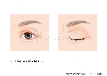One eye wrinkle fine wrinkle eyelashes female face eyes closed eyelids ophthalmology case aging real illustration 73366850