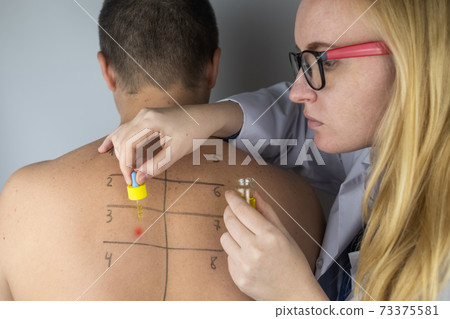An allergist in the laboratory conducts an allergy prick-test. Skin test for household, food, epidermal allergic reactions. The test is performed on the patient back 73375581
