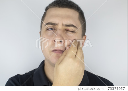 A man stands in front of a mirror and sees inflammation of the upper eyelid. Redness of the skin around the eyes and blepharitis. 73375957