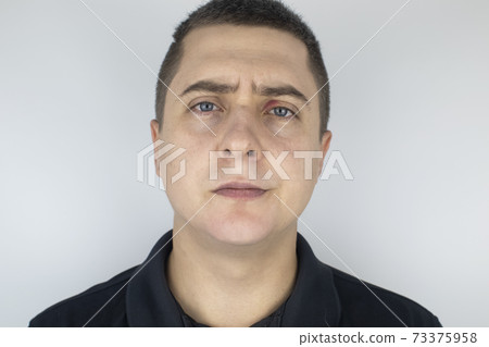 A man stands in front of a mirror and sees inflammation of the upper eyelid. Redness of the skin around the eyes and blepharitis. A man stands in front of a mirror and sees inflammation of the upper eyelid. Redness of the skin around the eyes and blepharitis. 73375958