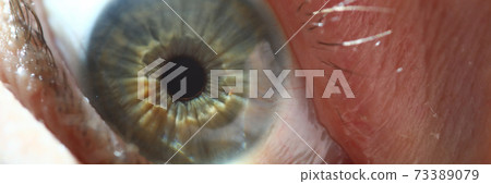 Check vision at optician Check vision at optician 73389079
