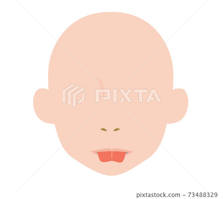 Illustration that becomes a heart shape when the tongue is stretched due to ankyloglossia Illustration that becomes a heart shape when the tongue is stretched due to ankyloglossia 73488329