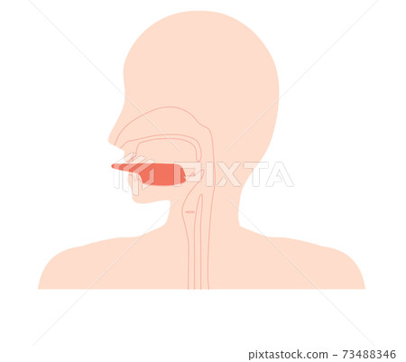 Illustration of a free tongue with a broken tongue zonule Illustration of a free tongue with a broken tongue zonule 73488346