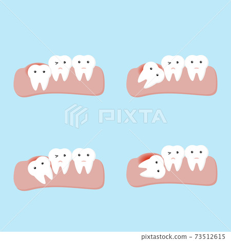 impacted tooth or wisdom teeth dental and oral diseases 73512615