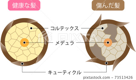 頭髮如何運作健康的頭髮和受損的頭髮 頭髮如何運作健康的頭髮和受損的頭髮 73513426