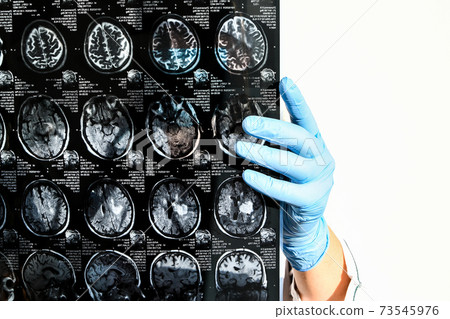 Doctor in protecting gloves holding brain MRI in medical office. MRI scan of human head in clinic. Doctor in protecting gloves holding brain MRI in medical office. MRI scan of human head in clinic. 73545976