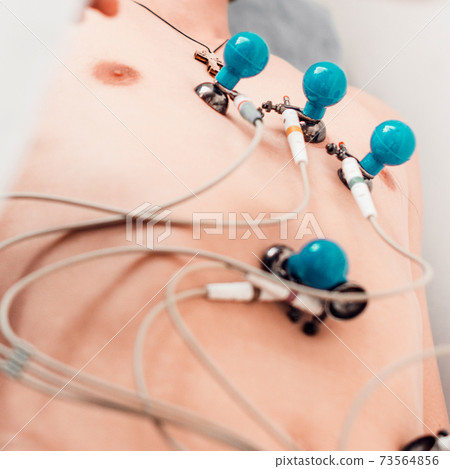 The nurse prepares the patient for the cardiogram, the cardiograph and the patient, the medical device for measuring the cardiogram. The nurse prepares the patient for the cardiogram, the cardiograph and the patient, the medical device for measuring the cardiogram. 73564856