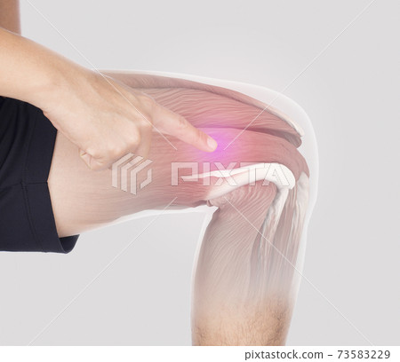thigh muscle inflammation feel pain 73583229