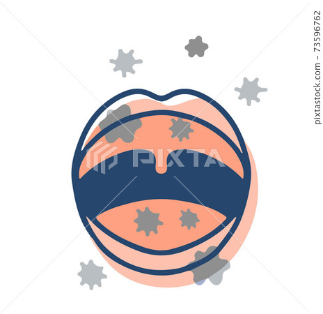 口腔有感染風險 73596762