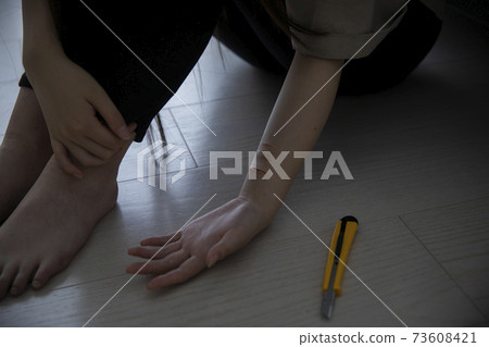 Wrist cut image Wrist cut image 73608421