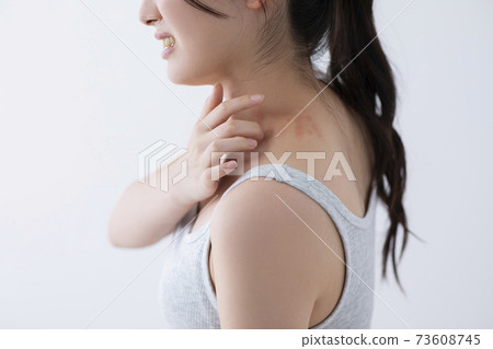 Urticaria image (special make-up) 73608745