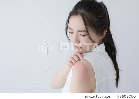 Sunburn image (special make-up) 73608790