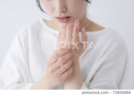 Rough hand image (special make-up) Rough hand image (special make-up) 73608866