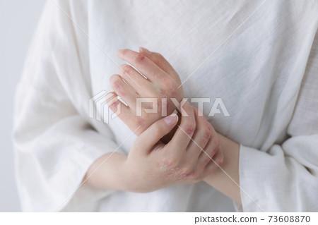 Rough hand image (special make-up) 73608870