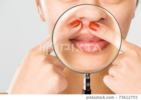 Enlarge the acne on a woman's face with a magnifying glass. 73612755