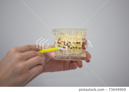 Typodont with braces, brushing teeth example Typodont with braces, brushing teeth example 73649909