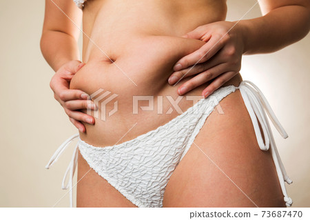 一個抓住腹部脂肪的女人。 一個抓住腹部脂肪的女人。 73687470