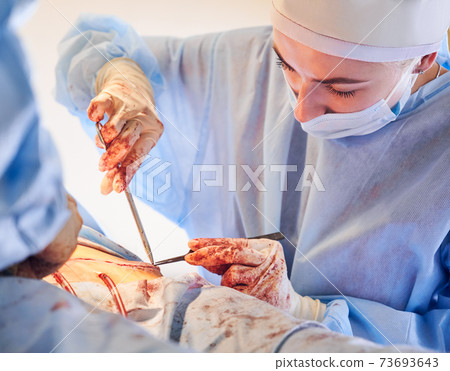 Female doctor stitching up wound after abdominoplasty procedure. 73693643
