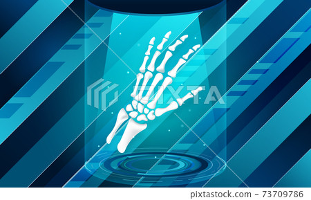 Technology for treatment of bone hand injury. Abstract traumatology and orthopedics. Medical science in the hospital for body joints. 73709786