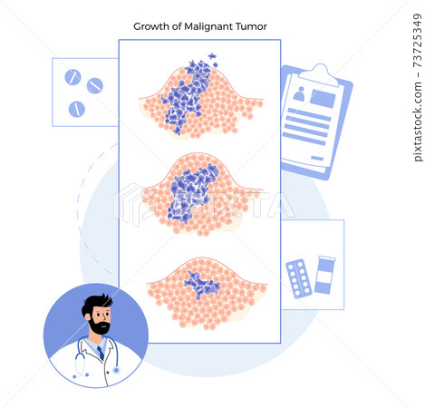 Tumor cells concept Tumor cells concept 73725349