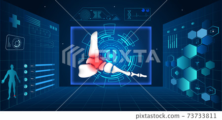 The technology of medical treatment for orthopedic traumatology. Doctor give treatment for a patient who has a foot and ankle injury. Orthopedics medical molecule abstract. Vector illustration The technology of medical treatment for orthopedic traumatology. Doctor give treatment for a patient who has a foot and ankle injury. Orthopedics medical molecule abstract. Vector illustration 73733811