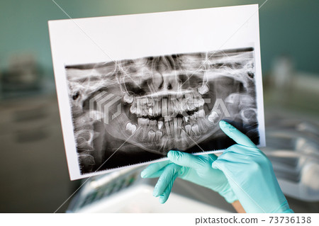Close up woman dentist holding patient mouth digital film.The dentist explained about the oral cavity to the patient at the dental office Close up woman dentist holding patient mouth digital film.The dentist explained about the oral cavity to the patient at the dental office 73736138