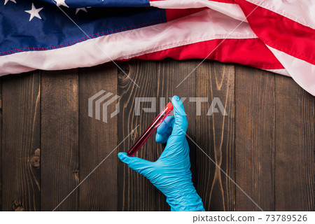 Hands of a doctor wearing gloves holding blood test tube coronavirus Hands of a doctor wearing gloves holding blood test tube coronavirus 73789526