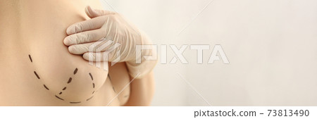 Cropped photo of lady getting ready for plastic surgery Cropped photo of lady getting ready for plastic surgery 73813490
