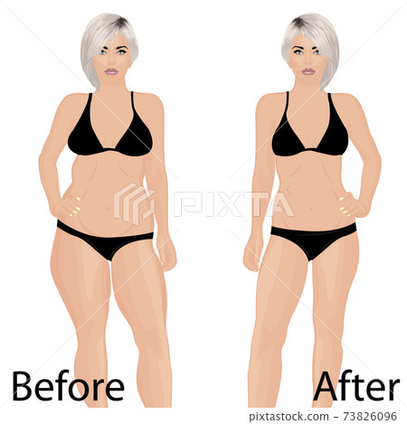 Woman body correction. Liposuction. Before and after. vector illustration Woman body correction. Liposuction. Before and after. vector illustration 73826096