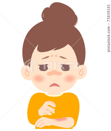 Women suffering from dry skin and skin problems 73839181