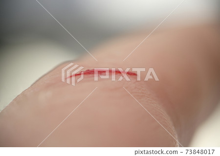 Cut with blood on the skin closeup Cut with blood on the skin closeup 73848017