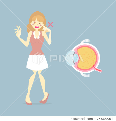 Woman Rubbing Her Eyes Eyeball Internal Stock Illustration 73863561 Pixta