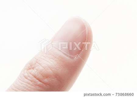 Nail care Nail care 73868660