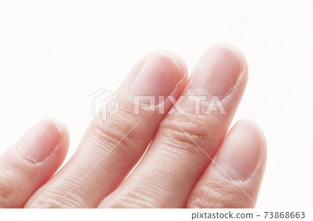 Nail care 73868663