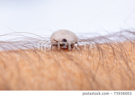 Tick on human hand Tick on human hand 73936003