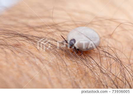 Tick on human hand 73936005