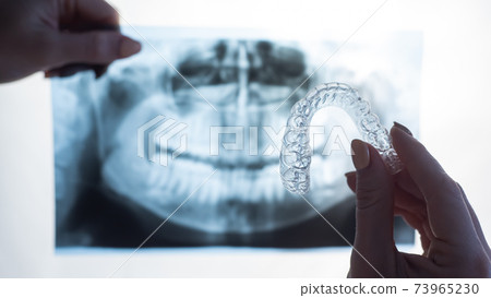 Female hands with transparent mouth guards for correcting bite and x-ray of the jaw. The orthodontist holds the equipment of the orthodontist Female hands with transparent mouth guards for correcting bite and x-ray of the jaw. The orthodontist holds the equipment of the orthodontist 73965230
