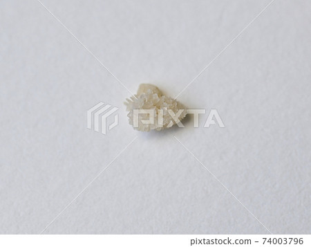 輸尿管結石終於被崇拜 74003796