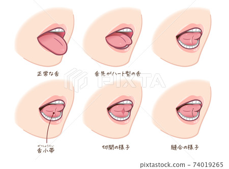 後遺症的插圖 74019265