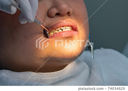 Dentist holding magifying mirror while checking teeth braces for woman 74034820
