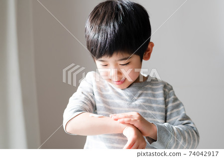 Boys applying moisturizing cream to dry skin 74042917