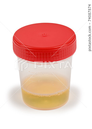 Urine sample in container. Urine sample in container. 74087874